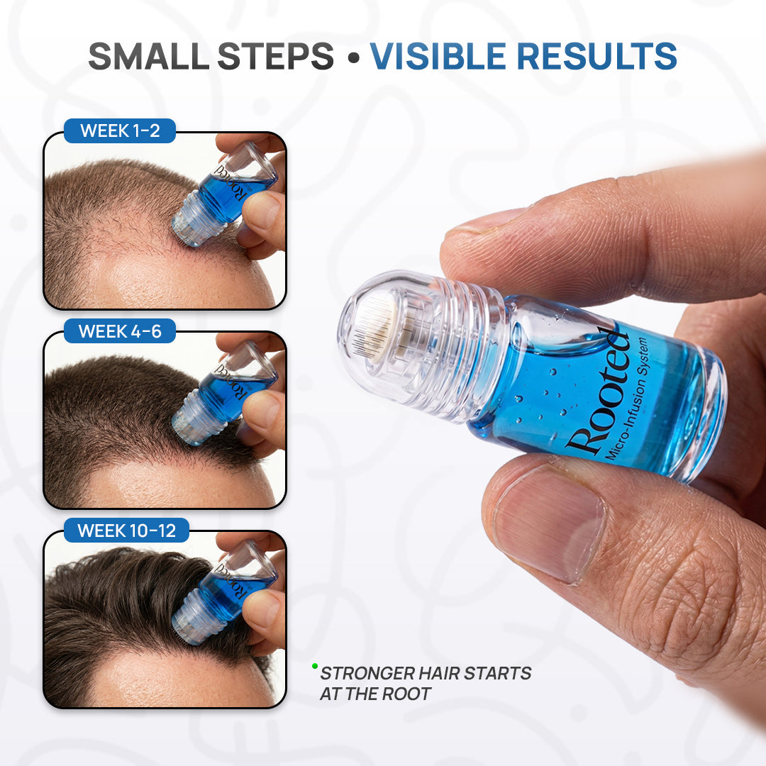 Rooted Foligen - Peptide Powered Hair Growth Elixir with GHK-CU